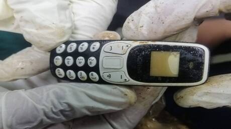 في واقعة نادرة.. استخراج هاتف محمول من بطن شاب مصري بعد عامين من ابتلاعه